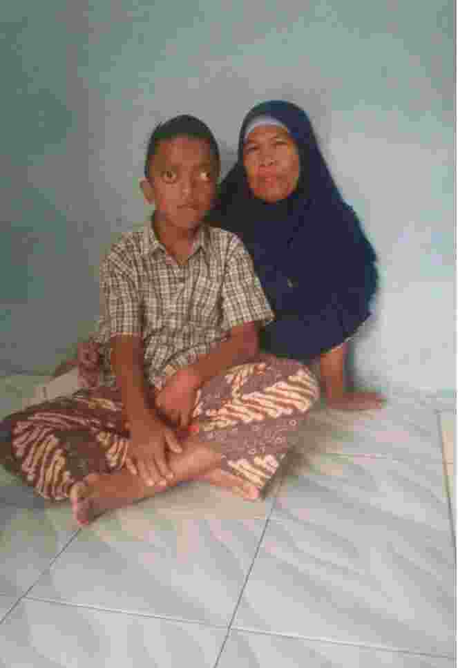 Seorang Anak Usia 11 Tahun Di Kampung Munju Desa Mekarmulya Terkena Tumor Ganas