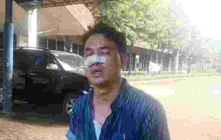 Seorang Wartawan Dikeroyok Oknum Calo Satpas SIM, Polisi Harus Tangkap Pelakunya