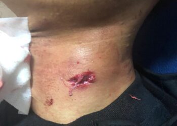 Sedang Membuka Jalur Lalin Korban Kecelakaan, Seorang Pemuda Ditembak OTK 