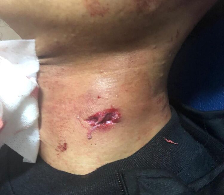 Sedang Membuka Jalur Lalin Korban Kecelakaan, Seorang Pemuda Ditembak OTK 