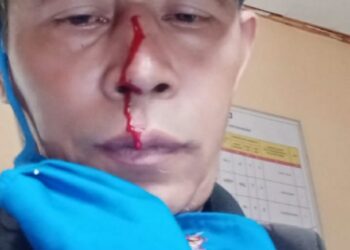 Setelah Simalungun dan Gorontalo, Kini Wartawan di Majalengka di Intimidasi dan di Tonjok Oknum Ormas