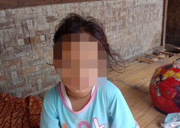 Seorang Ibu Siksa Anak Tiri Gara-gara Kesal Sering Ngompol 😧