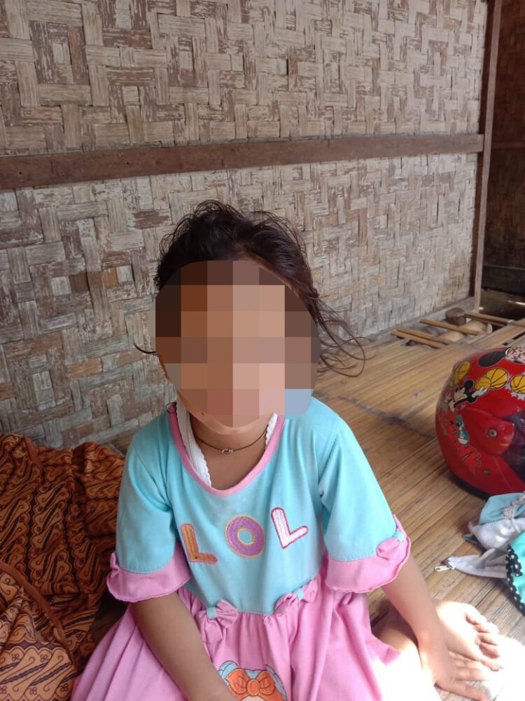 Seorang Ibu Siksa Anak Tiri Gara-gara Kesal Sering Ngompol 😧