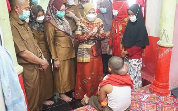 Kunjungi Penderita Tumor Otak, Bunda Winarni Beri Semangat bagi Hendrik Alzaini