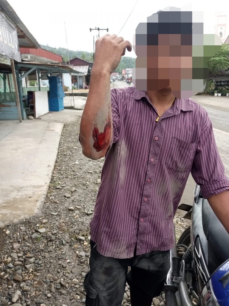 Tokoh Pemuda Kabupaten Nias Desak Penyelesaian Pembangunan Jembatan Gidō