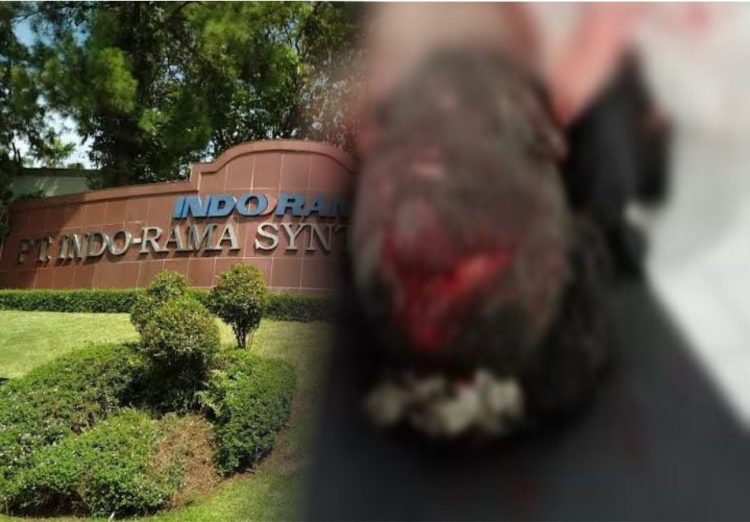 PT. Indorama Bungkam, Pospera Akan laporkan Kecelakaan Kerja Ke Lembaga Sertifikasi ISO dan OHSAS