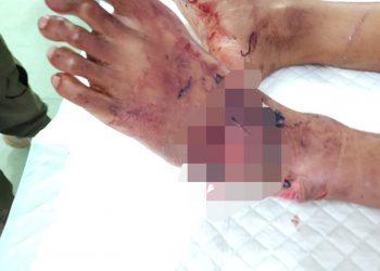 Sadis ..!! Akibat Tersinggung Ketiban Pasir Seorang Kuli Bangunan Di Bacok Teman Sendiri Di Pulau Karang Beras