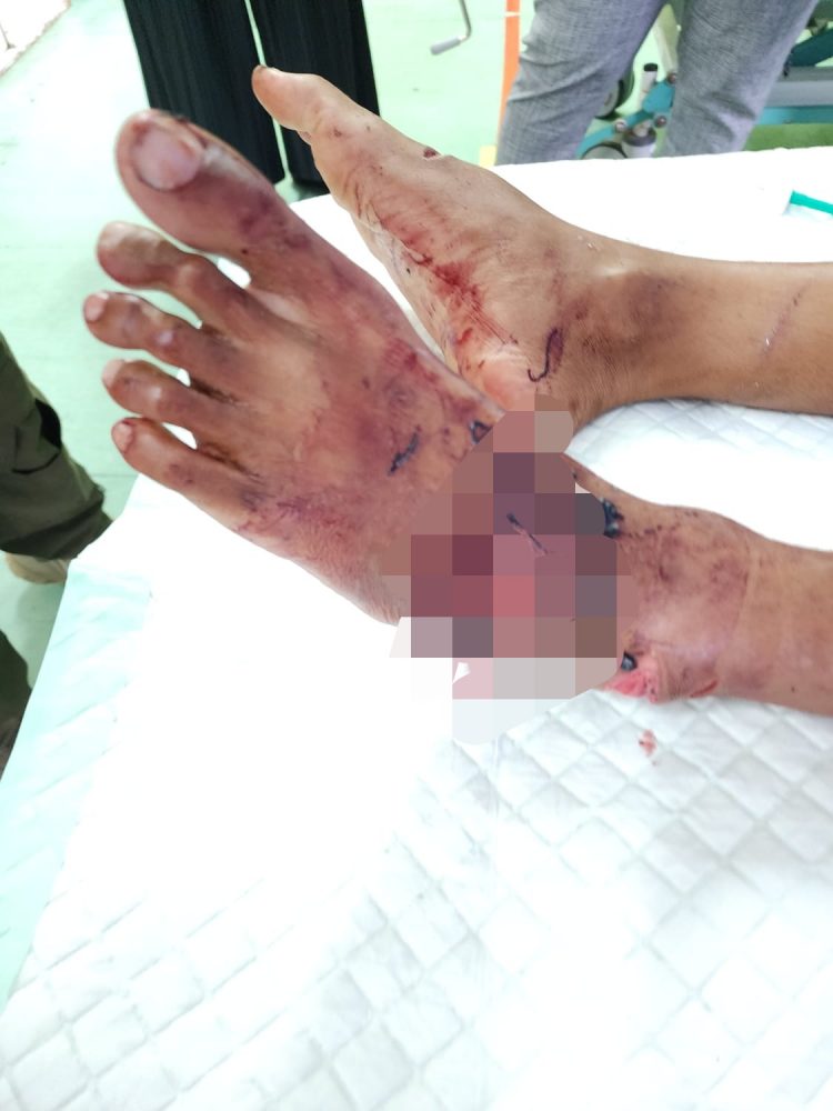 Sadis ..!! Akibat Tersinggung Ketiban Pasir Seorang Kuli Bangunan Di Bacok Teman Sendiri Di Pulau Karang Beras