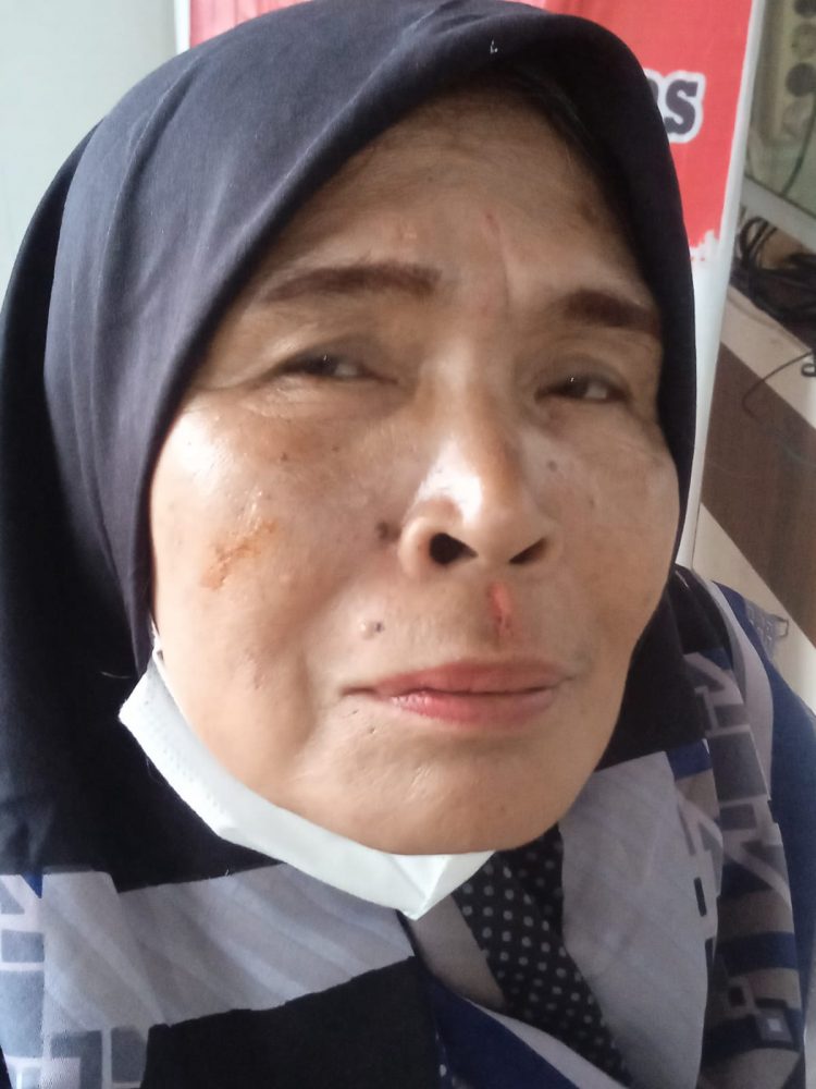 Siti Maslah Lubis Bendahara MIO Tebing Tinggi, Laporkan SN Caleg Wanita Partai Gelora Pelaku Penganiayaan!