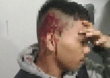 BFI Diduga Sewa Depkolektor Ganas Bersenjata Tajam, Bacok Warga Cimahi!