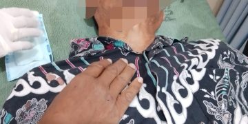 SALAMUN UMUR 45 TAHUN MENGALAMI PATAH GIGI DAN MEMAR SELURUH BADAN DIDUGA DIANIYAYA TETANGGA INISIAL (MS)