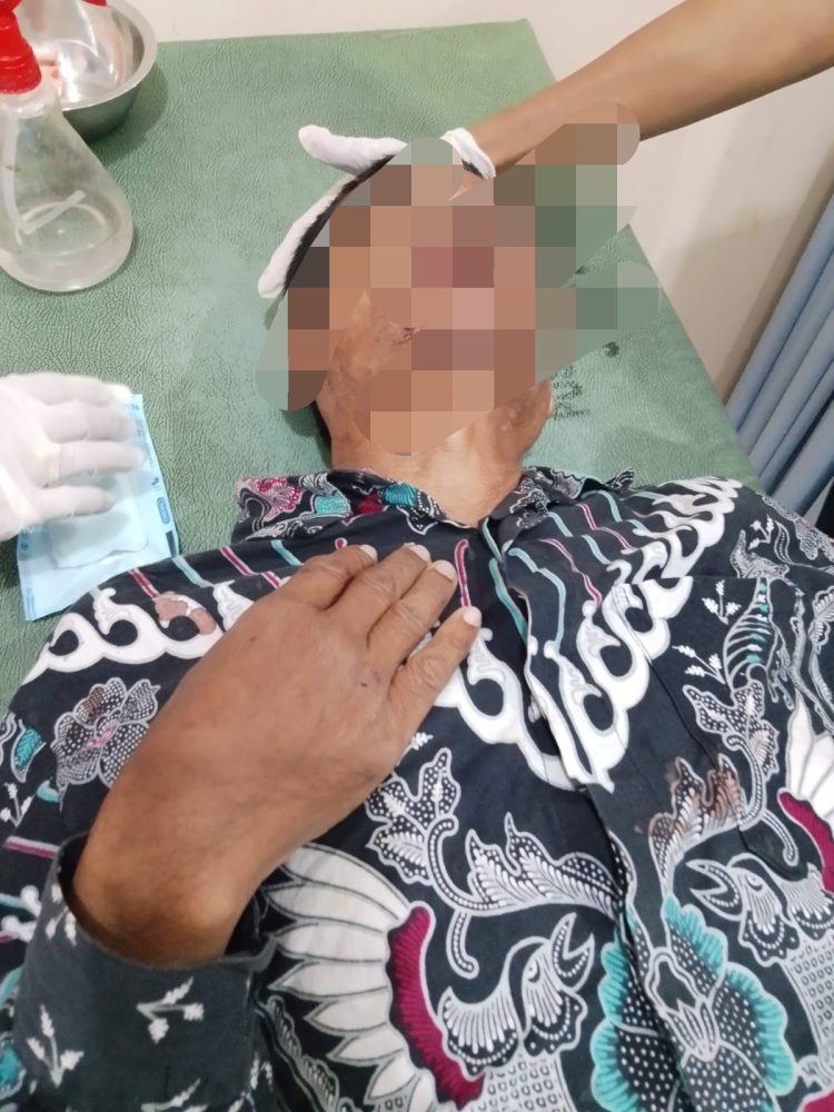 SALAMUN UMUR 45 TAHUN MENGALAMI PATAH GIGI DAN MEMAR SELURUH BADAN DIDUGA DIANIYAYA TETANGGA INISIAL (MS)